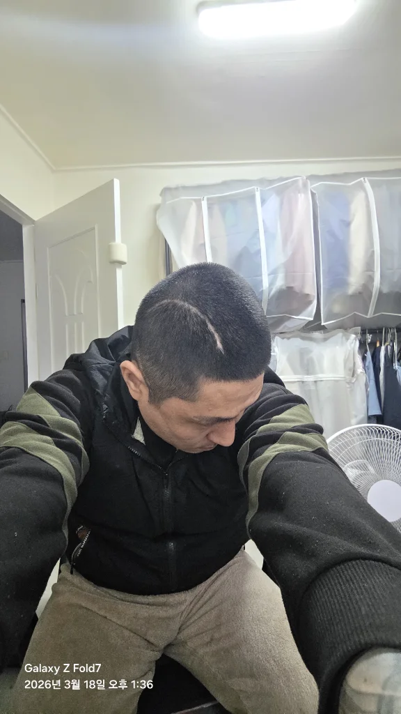 이미지 2