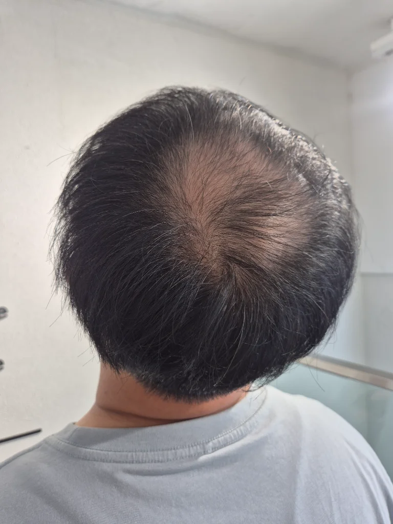 이미지 3
