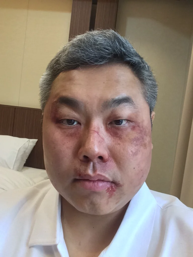이미지 2