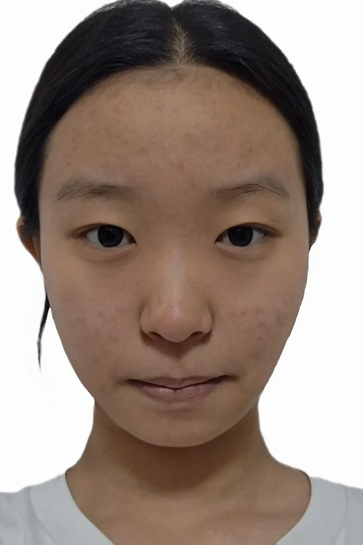 이미지 1