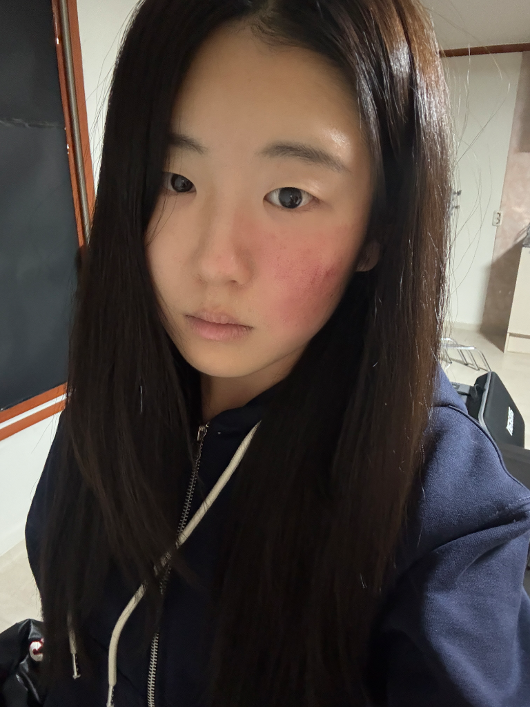 이미지 11